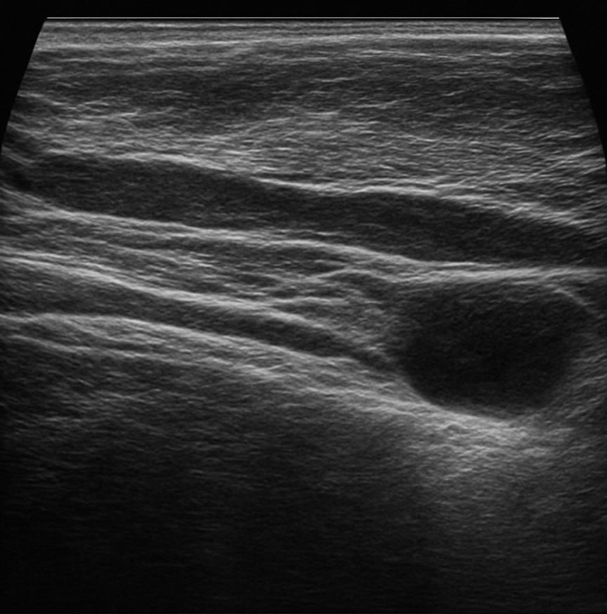 Ecografia Centro Diagnostico Polispecialistico Semeraro